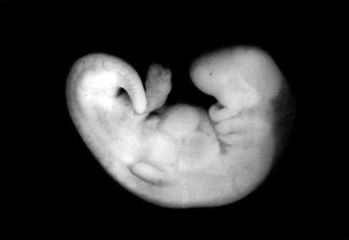 Histology practical: human embryo in the stage of the three parts, with pars cranialis, pars umbilicalis and pars caudalis