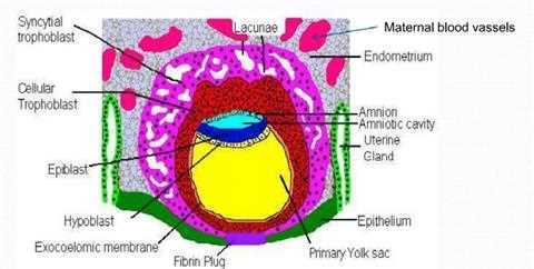 Student notes version of the implanted embryo: syncytial trophoblast, cellular trophoblast, epiblast, hypoblast, exocoelomic membrane, fibrin plug, lacunae, maternal blood vessels, endometrium, amnion, amniotic cavity, uterine gland, epithelium, primary yolk sac