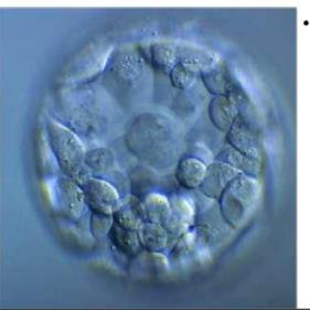 Photograph of an early blastocyst, a ring of cells around a cavity with a cell clump (student notes)