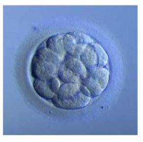 Photograph of a morula, a rounded ball of cells