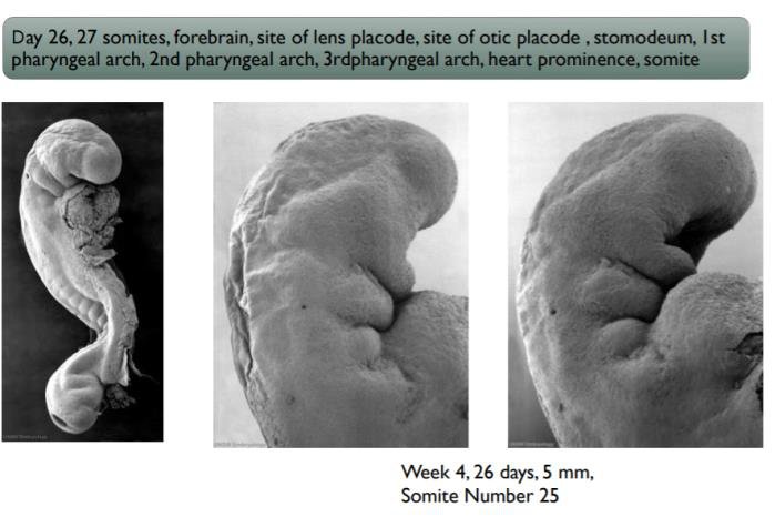 Student notes: day 26 to 27 embryo with 27 somites, forebrain, sites of the lens and otic placodes, stomodeum, 1st to 3rd pharyngeal arches, heart prominence; SEMs of week 4, 26 days, 5 mm, somite number 25