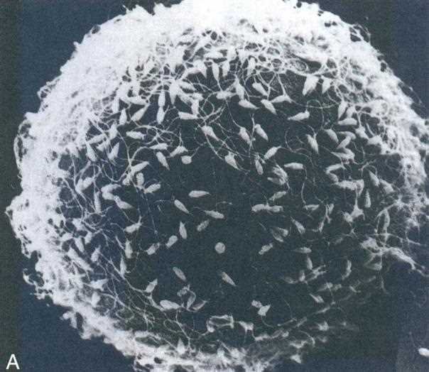 Scanning electron micrograph of many sperm on the surface of the egg with its surrounding cells (A)