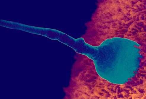 Coloured scanning electron micrograph of a sperm head attached to the egg surface