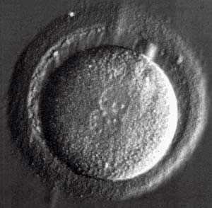 Human zygote: a large round cell inside the zona pellucida