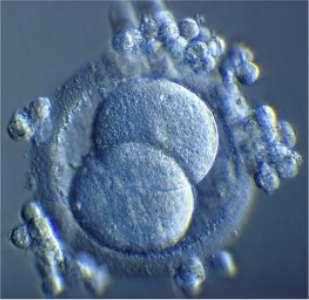 Two-cell stage: two large blastomeres inside the zona pellucida