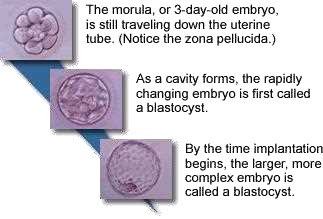 Morula of 3 days, still travelling down the uterine tube (zona pellucida), then the cavity forms and the embryo is called a blastocyst; at implantation the larger, more complex embryo is still called a blastocyst