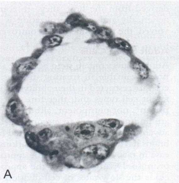 Black and white section through a blastocyst: a thin trophoblast wall and a clump of inner cells (A)