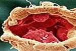 Coloured scanning electron micrograph of the implanting blastocyst, red, embedded in the uterine surface