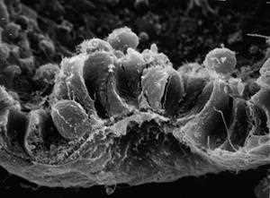 Scanning electron micrograph of the cells of the inner cell mass of the blastocyst
