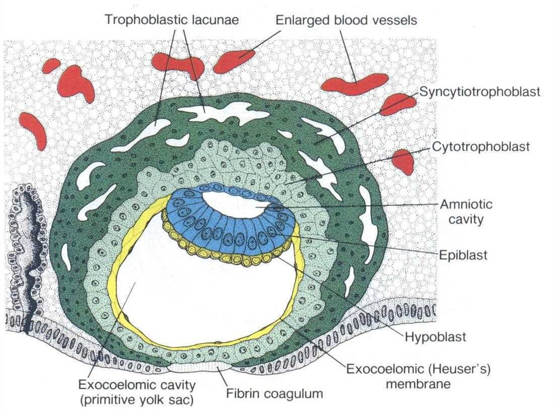 Implanted bilaminar embryo: trophoblastic lacunae, enlarged blood vessels, syncytiotrophoblast, cytotrophoblast, amniotic cavity, epiblast, hypoblast, exocoelomic cavity (primitive yolk sac), exocoelomic (Heuser's) membrane, fibrin coagulum
