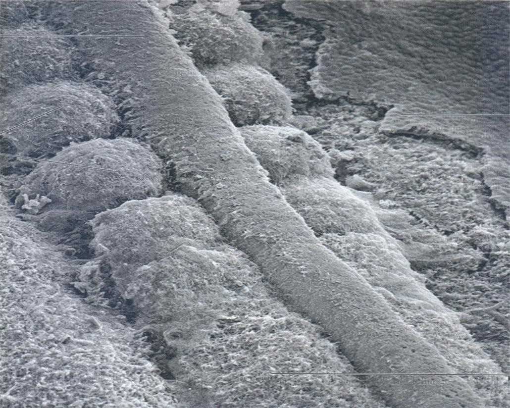 Scanning electron micrograph of the notochord as a ridge between the somites
