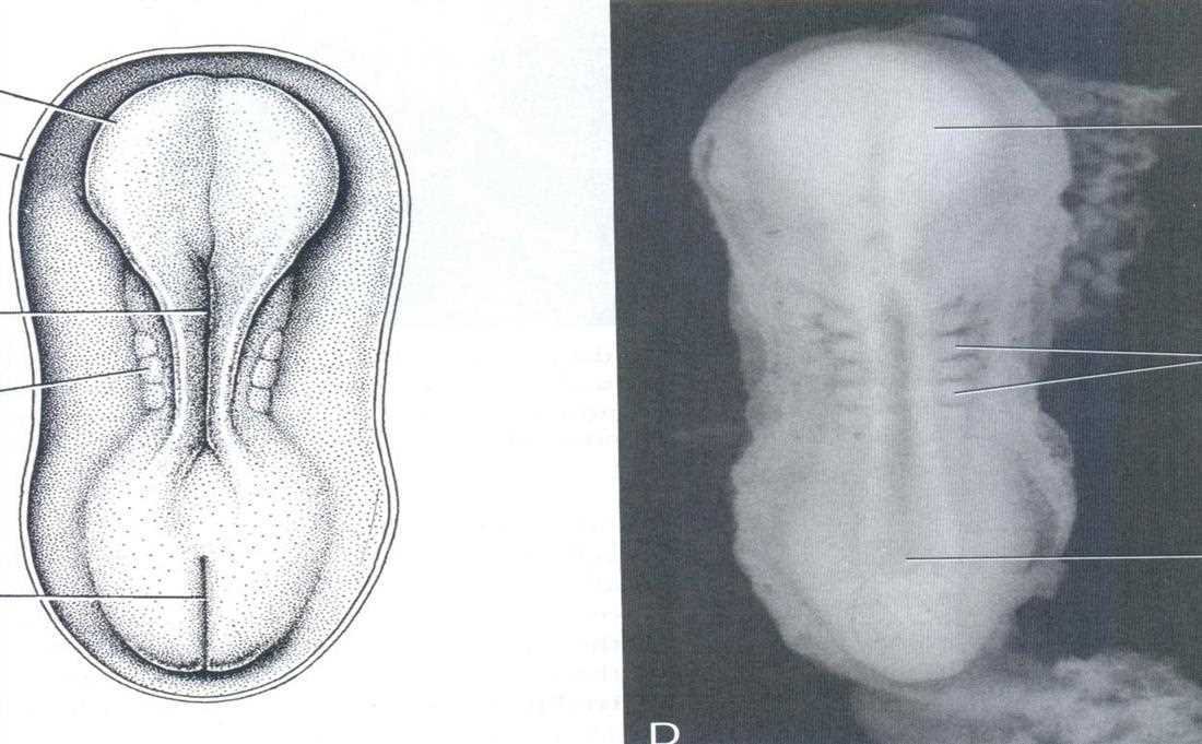 Dorsal view of a later embryo with the neural folds, somites and primitive streak (C, D)