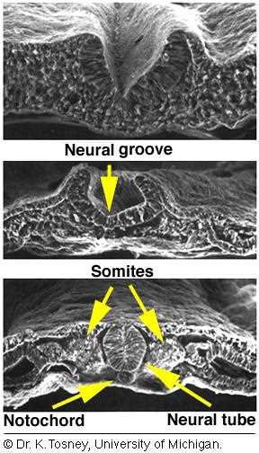 Neurulation in three SEM sections: neural groove, somites, notochord and neural tube (yellow arrows)