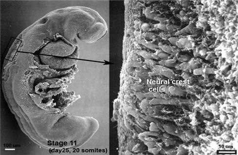 Embryo (stage 11, day 25, 20 somites) with the neural crest cells enlarged in the cranial region