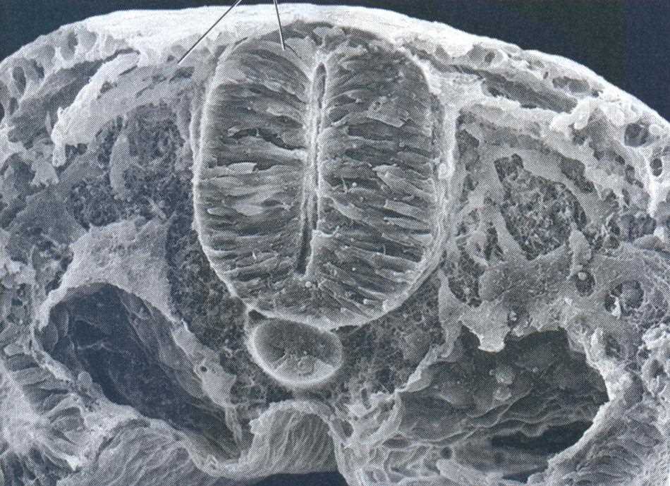 Scanning electron micrograph, transverse section: neural tube and neural crests (lecture labels: neural tube, neural crests)