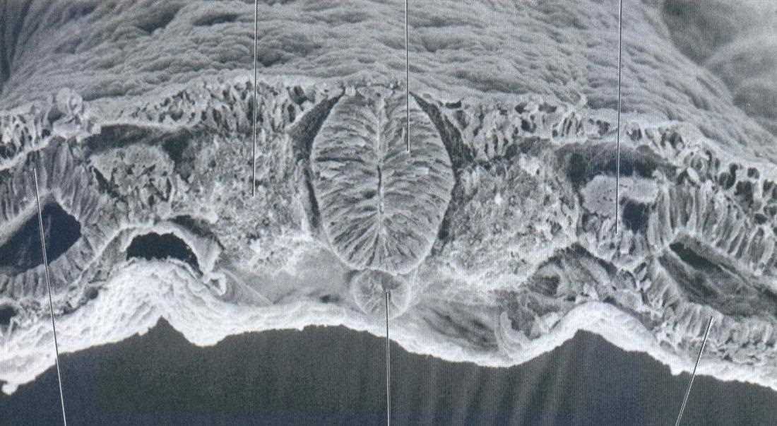 Scanning electron micrograph, transverse section of the embryo (lecture labels: somites, neural tube, notochord, paraxial mesoderm, somatic mesoderm)