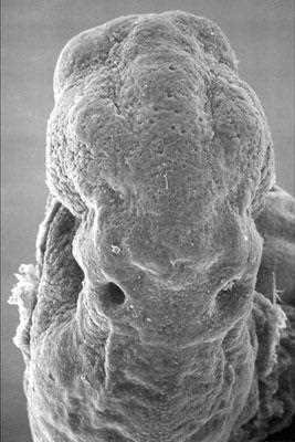 Scanning electron micrograph of the cranial end of the embryo seen from the front