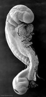 Whole embryo at week 4, day 26, 5 mm, somite number 25, from the side (SEM)