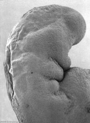 Head of the 26-day embryo seen from the side: forebrain bulge, pharyngeal arches and heart prominence (SEM)