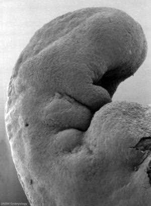 Head of the 26-day embryo, second view, with the pharyngeal arches and the heart prominence