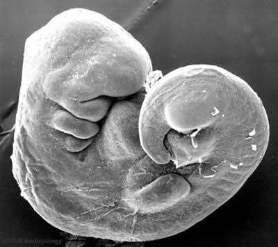 Scanning electron micrograph of the embryo head and pharyngeal arches with the heart