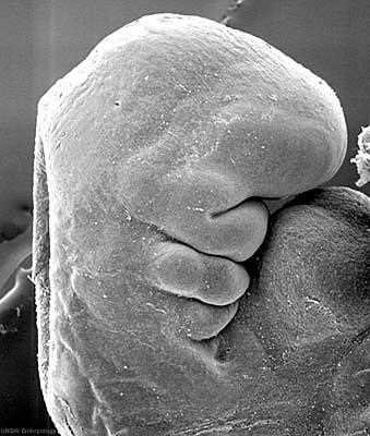 Closer scanning electron micrograph of the head, pharyngeal arches and heart