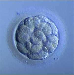 Practical exam slide 2, the morula: a ball of 10 to 32 cells in the zona pellucida