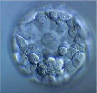 Practical exam slide 3, the blastocyst: a hollow ball with fluid-filled cavity and a small inner cell mass