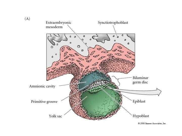 Practical exam slide 4, the bilaminar germ disc: extraembryonic mesoderm, syncytiotrophoblast, amniotic cavity, primitive groove, yolk sac, bilaminar germ disc, epiblast, hypoblast