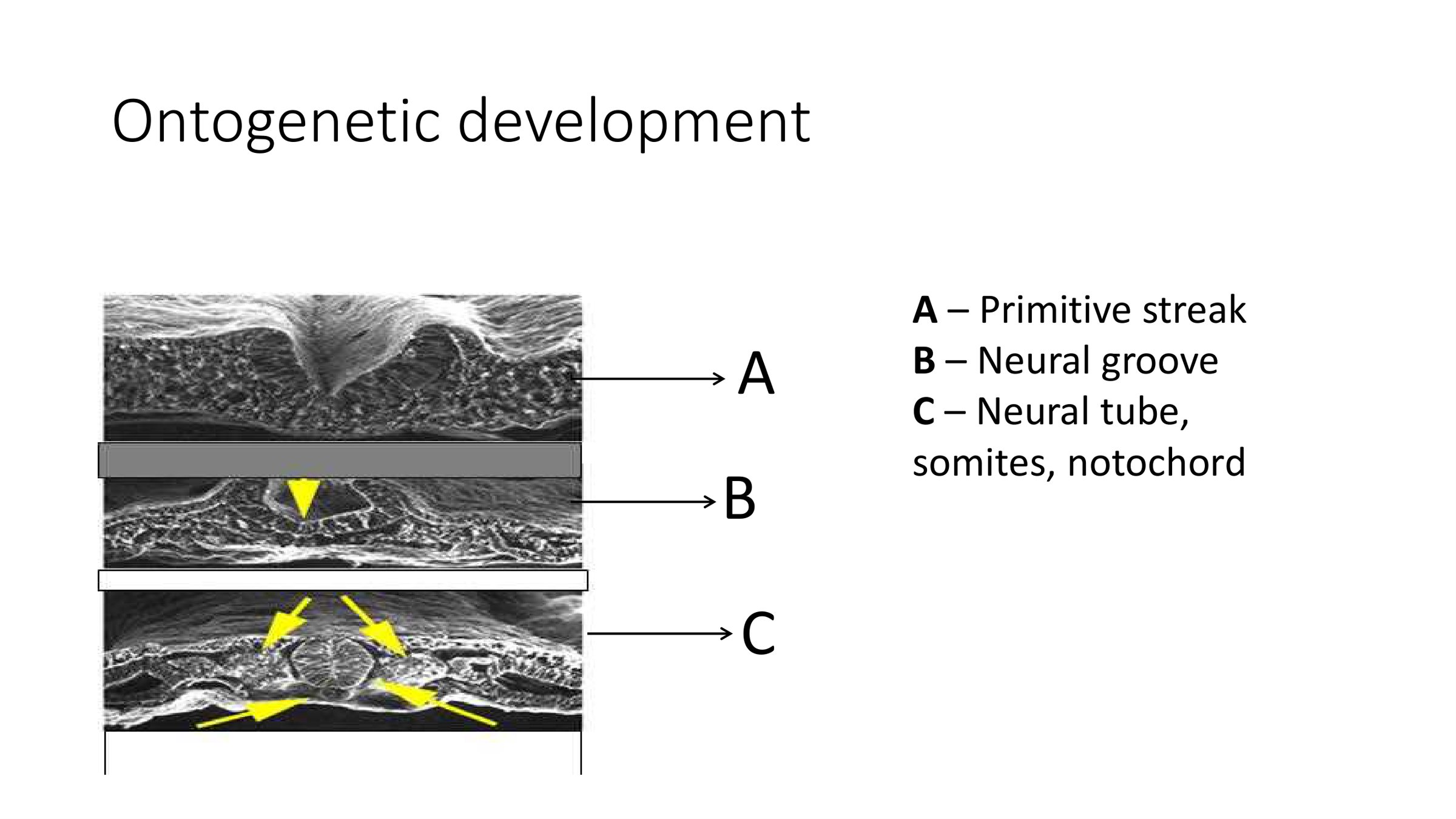 Practical exam slide 9, Ontogenetic development: A primitive streak, B neural groove, C neural tube, somites and notochord