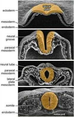 Ten Cate: scanning electron micrographs of the formation and closure of the neural fold elevations; ectoderm, neural plate, neural groove, neural tube, paraxial mesoderm, lateral plate mesoderm, somite, notochord, endoderm