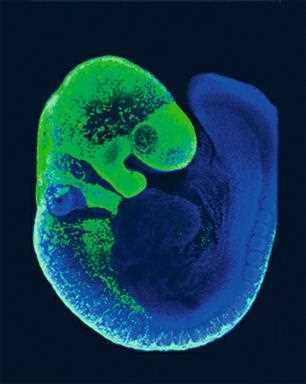 Ten Cate: migration of neural crest cells throughout the embryo traced in a Pax3-GFP transgenic mouse model (green)