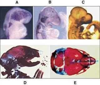 Ten Cate: migration and differentiation of cranial neural crest cells (A migrating NCC, B and C neuronal differentiation, D skeletal differentiation, E neurocranium, bone red and cartilage blue)