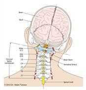 Head and neck: skull, brain, brain stem, cervical spine vertebrae C1 to C7 and spinal cord, labelled