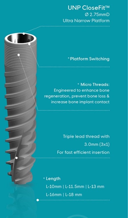 Ultra-narrow platform implant, 2.75 mm in diameter, labelled for platform switching, micro threads, a triple-lead thread with 3.0 mm lead, and lengths from 10 mm to 18 mm