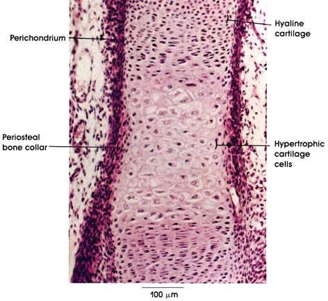 Microscopic section through a developing long bone end, labelled: perichondrium, hyaline cartilage, periosteal bone collar, and hypertrophic cartilage cells