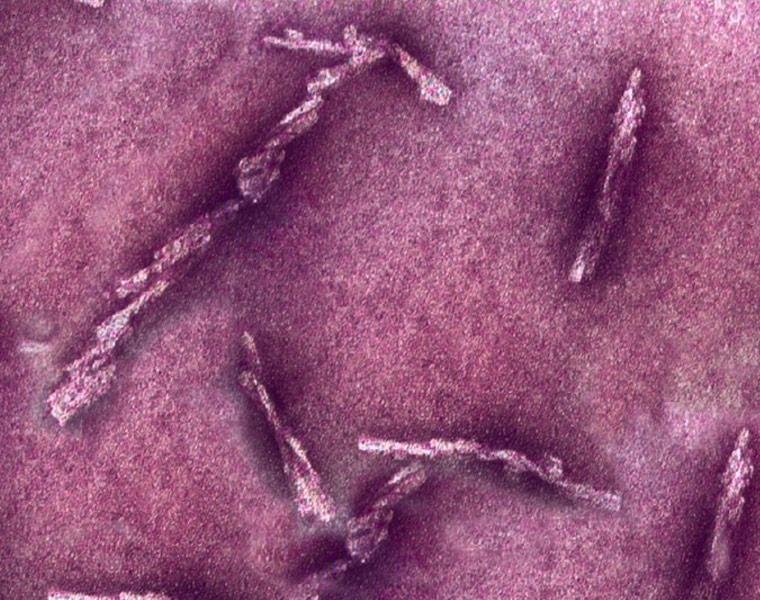 Electron micrograph of amyloid fibrils as elongated, twisted, rod-shaped filaments