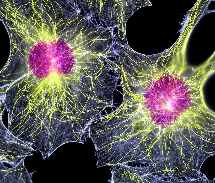Fluorescence micrograph of the cytoskeleton in two cells: microtubules radiating yellow-green from pink centrosomes, with actin and intermediate filaments in the surrounding network