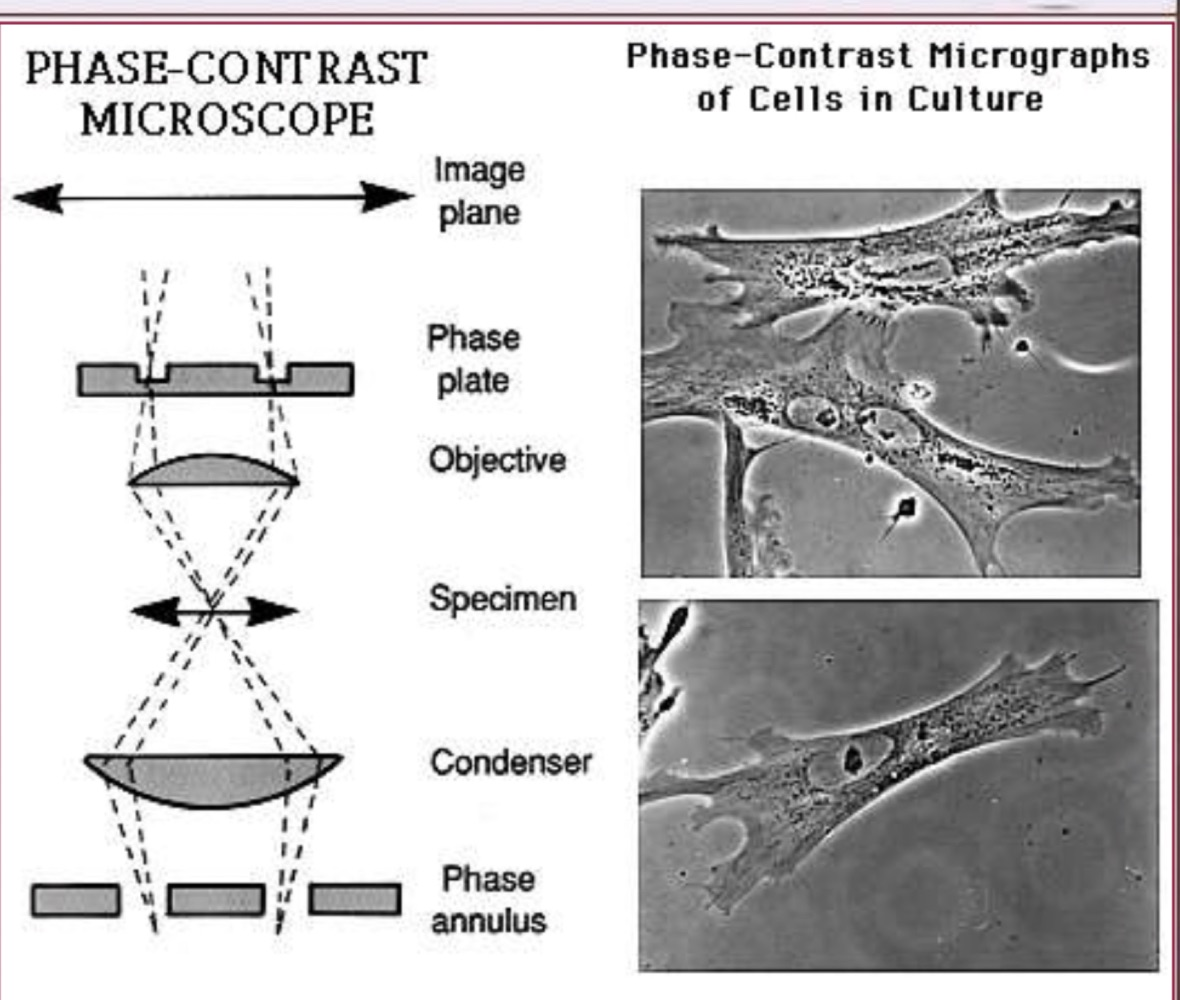 Diagram of a phase-contrast microscope beside phase-contrast micrographs of cells in culture